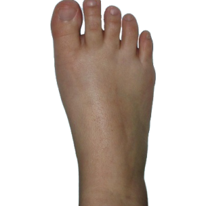 Barefoot PNG