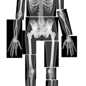 X-rays PNG