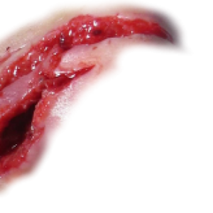 Scar PNG