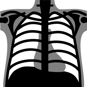 X-rays PNG
