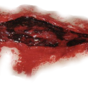 Scar PNG