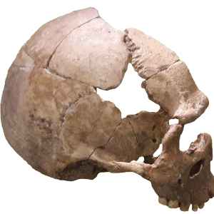 Skull