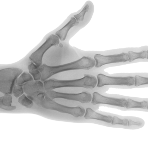 X-rays PNG