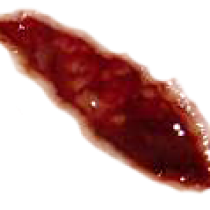 wound PNG image
