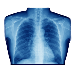 X-rays PNG