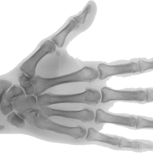 X-rays PNG