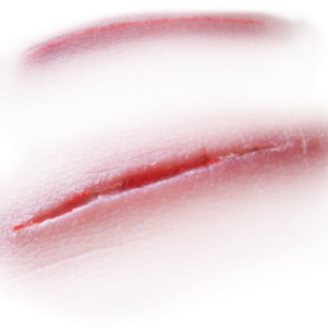 Scar PNG