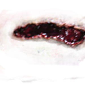 wound PNG image