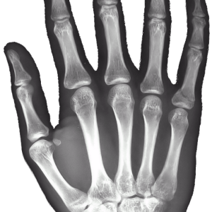 X-rays PNG
