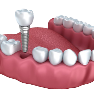 teeth png